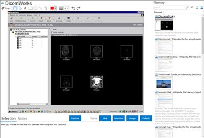 DicomWorks - Flamory bookmarks and screenshots
